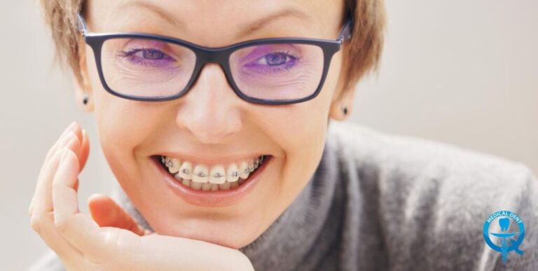 Obraz przedstawia zbliżenie na uśmiechniętą twarz młodej kobiety noszacej aparat ortodontyczny na zębach. Ma ona na sobie okulary i wygląda radośnie. Zdjęcie ma na celu zilustrować temat "Noszenie aparatu ortodontycznego – fakty i mity", ale pomija identyfikację osoby.