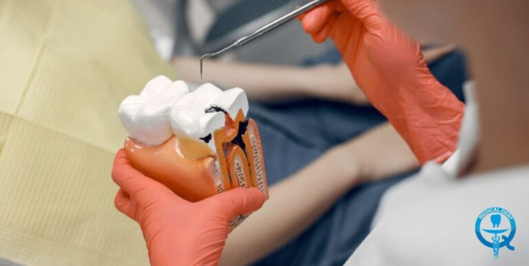 Obraz przedstawia zbliżenie na rękę dentysty trzymającą narzędzie stomatologiczne oraz model zębów, na którym widoczne są jasne oznaczenia osadu nazębnego. Zdjęcie służy do zilustrowania zagadnienia dotyczącego występowania osadu na zębach, jego przyczyn i metod usuwania.