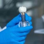 Osoba w niebieskich rękawiczkach trzyma model implantu dentystycznego (korona zęba, łącznik i podstawa) w klinicznym środowisku.