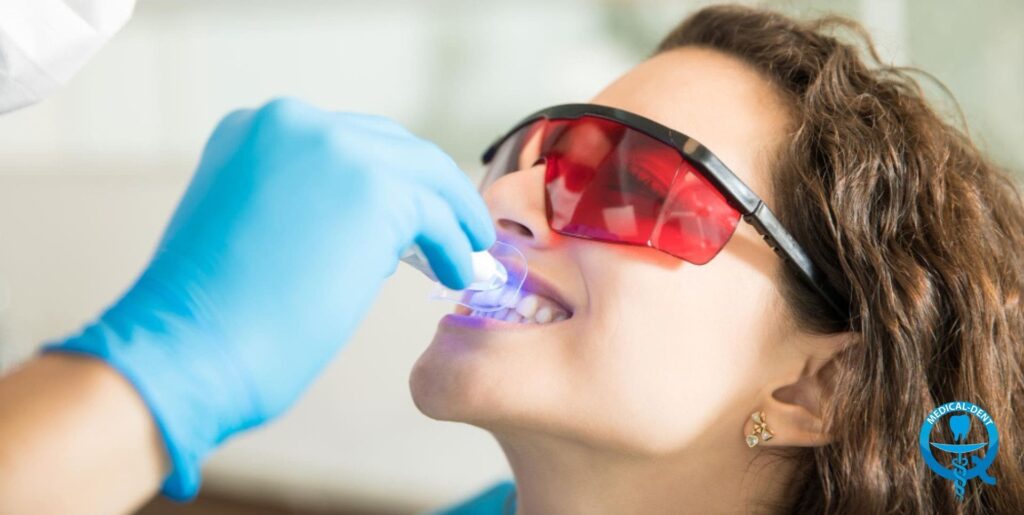 Zabieg wybielania zębów: dentysta w rękawiczkach aplikuje preparat na zęby pacjenta za pomocą urządzenia, pacjent nosi ochronne okulary.