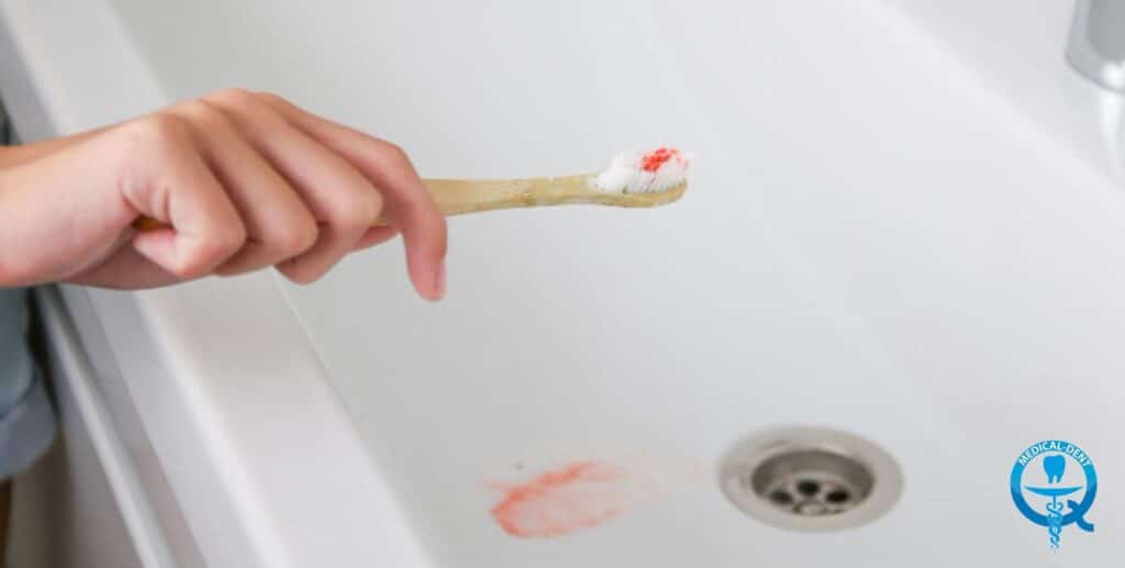 Ręka trzyma szczoteczkę do zębów z pastą i krwią na włosiu, nad umywalką z plamą krwi w odpływie.