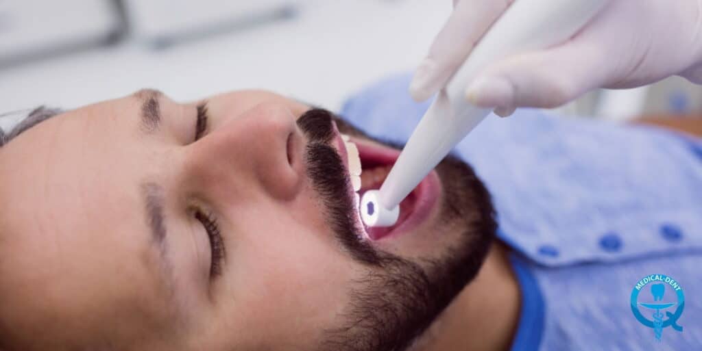 Dentysta w rękawiczkach stosuje narzędzie do wypełnienia zęba pacjenta po leczeniu kanałowym. Pacjent leży na fotelu dentystycznym z otwartą buzią.