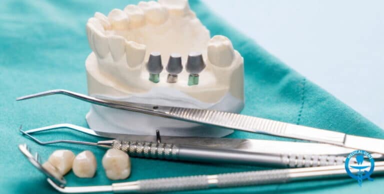 Dental model with implant abutments, dental instruments, and extracted teeth on a teal cloth, illustrating implantological crowns.